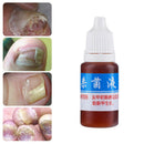 Anti Fungal Treatment Fungus Effective Finger Toe Nail Repair Liquid Solu F7X0