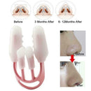 Nose Up Clip Bridge Lifting Shaping Straightening Corrector Tool S3 f4 M1M9 Z7C5