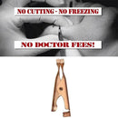 Micro Safe Skin Tag Remover Kit For Fast & Effective XAA Skin Tag 2021 R2V4