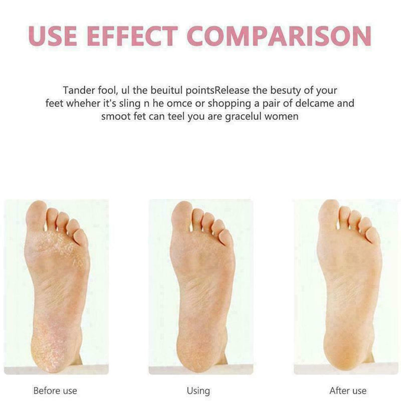 8pcs Remover Pedicure Rasp Foot File Scraper Brush Care Nail Set B9V7 Kit A9Y4