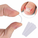 Ingrown Toenail Corrector Strips Brace 10pcs/bottle Straightener Clip Curved#