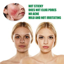 Aloe Vera Gel Hydrating Soothing Moisture Spray For Face Sunburn Body Skin K7G8