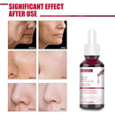 Face Peeling Serum Salicylic Acid Serum AHA30% BHA 2% Fruit Acid Extract