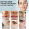 Lift Thread Chin Lift Thread Face Lifting Thread Collagen Silk Thread