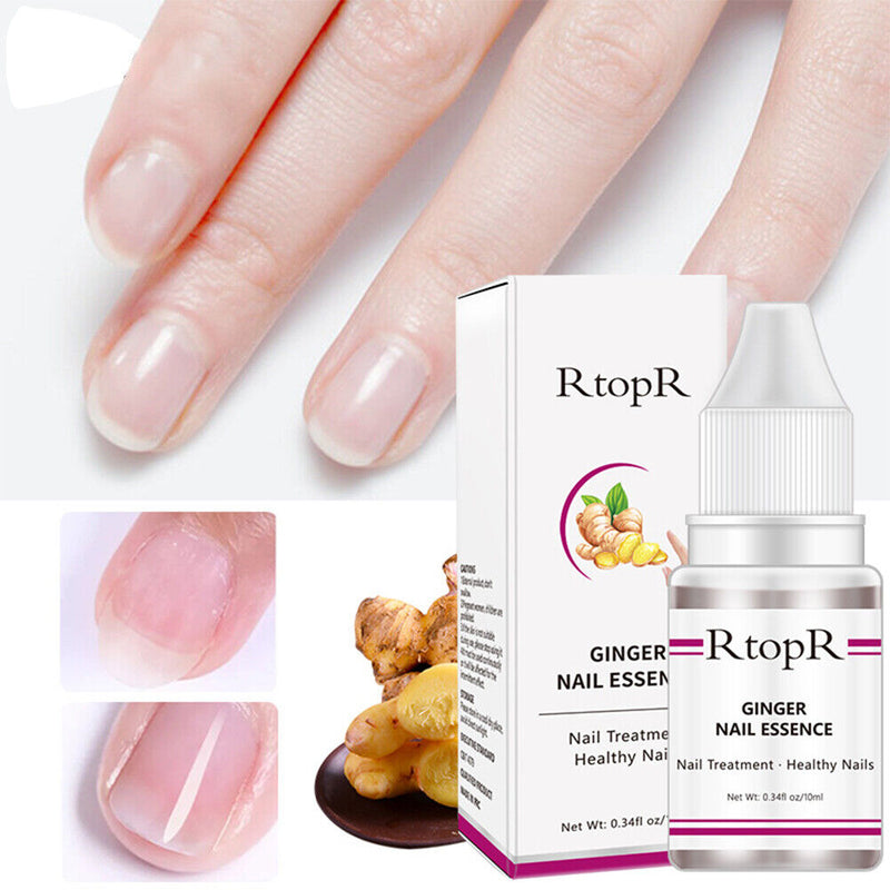 Ginger Nail Treatment Serum Hand and Foot Absorb Nutrients for Growing Heal