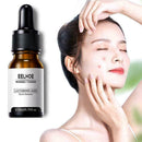 Eelhoe 10ML Instant Perfection Serum Pore Shrinking Serums P2T8