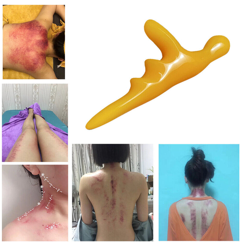 Gua Sha Acupuncture Stick Pain Relief Press Trigger Point Massager for Body