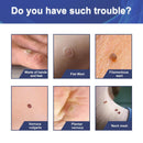 Skin Tag Remover Patches Acne Pimple Moles Wart Remover 144 Pcs`