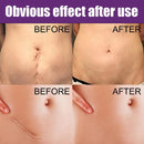 4pcs Silicone Scar Sheets Gel Strips Patch Adhesive Scar Removes (150mm)