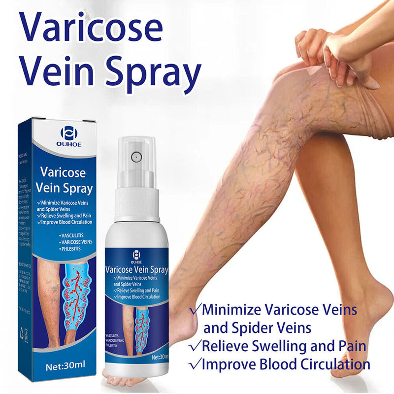 Varicose Vein Spray Improve Blood Circulation Soothing Leg Acid Bilges Itch