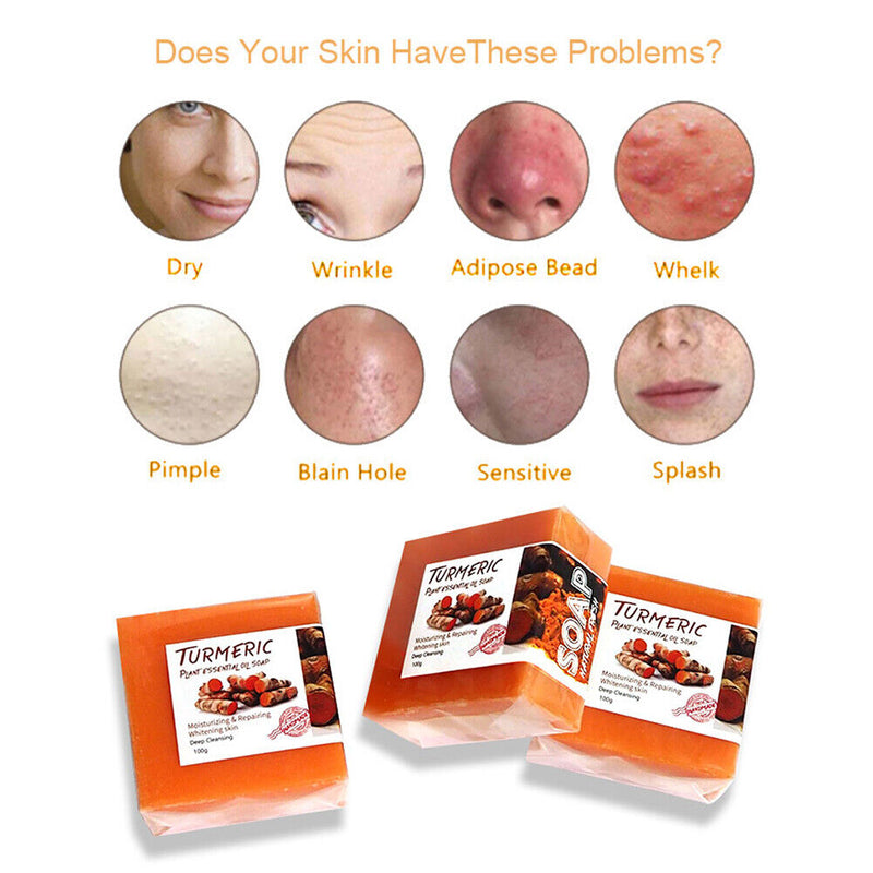 Turmeric Soap Face Cleansing Anti-Acne Skin Brighten Remove Dark Spot Whitening