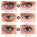 1Pcs Anti Dark Circles Eye Serum Anti Wrinkles Eye Bags Hyaluronic Acid Cream_