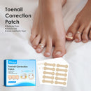 Ingrown Toenail Corrector Patches Treatment Tools for Inner Roll Armor Recovery