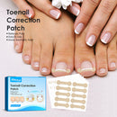 Ingrown Toenail Corrector Patches Treatment Tools for Inner Roll Armor Recovery