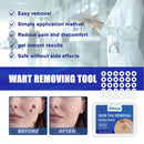 Rubber Skin Tag Remover Device Painless Safe Easy To Use Face Care Beauty Tools