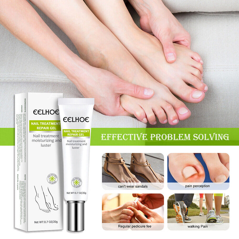 Paronychia Treatment Toe Health Foot Care Anti-Infection Gel