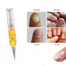 Beauty Moisturizing Enhance Damaged Cuticles Nail Cuticle Care Nail Repair Oil