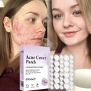 72pcs Skin Tag Remover Patches Hydrocolloid Acne Pimple Wart Remover Plaster.