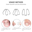 Ingrown Toe Nail Correction Hook/Rubber Band Paronychia Orthosis Corrector Clips
