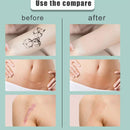 Flaw Hide Tape Birthmark Scar Acne Tattoo Cover Up Concealing Hide Stickers`
