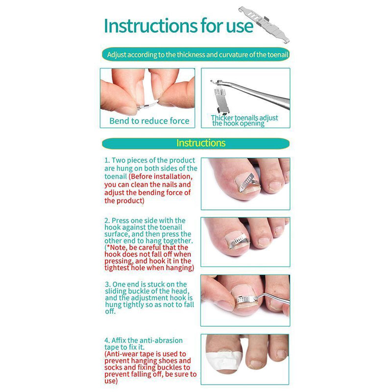 Ingrown Toenail Correction Tools Pedicure Recover Embed Toenail Treatment