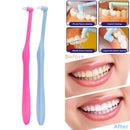 Interdental Toothbrush Orthodontic Small Head Soft Dental Cleaner Oral Tooth