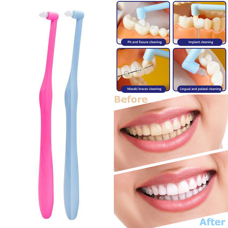 Interdental Toothbrush Orthodontic Small Head Soft Dental Cleaner Oral Tooth