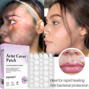 72pcs Skin Tag Remover Patches Hydrocolloid Acne Pimple Wart Remover Plaster.