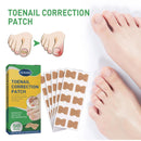 Ingrown Toenail Correction Stickers Nail Corrector Patches Nail Care Tool!