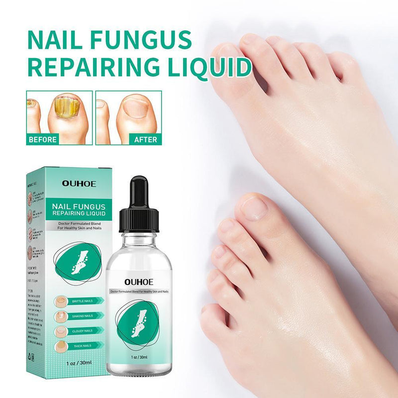30ml Toenail Fungus Oil Nail Care Repair Liquid for Anti Fungal Whitening