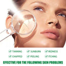 Aloe Vera Essence Spray Reduce Inflammation Redness Skin Sunburn Face Care