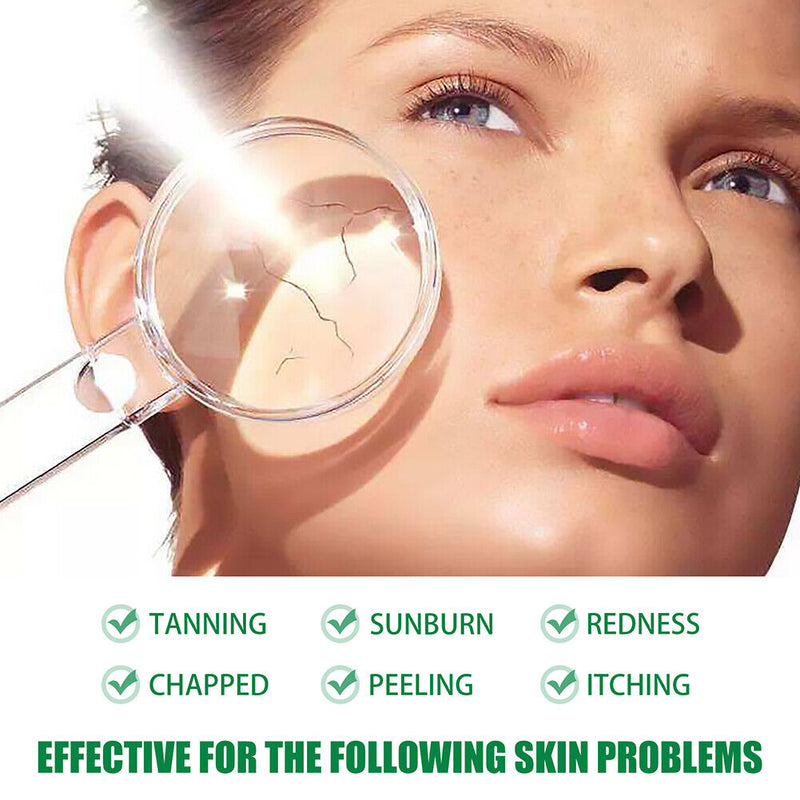 Aloe Vera Essence Spray Reduce Inflammation Redness Skin Sunburn Face Care