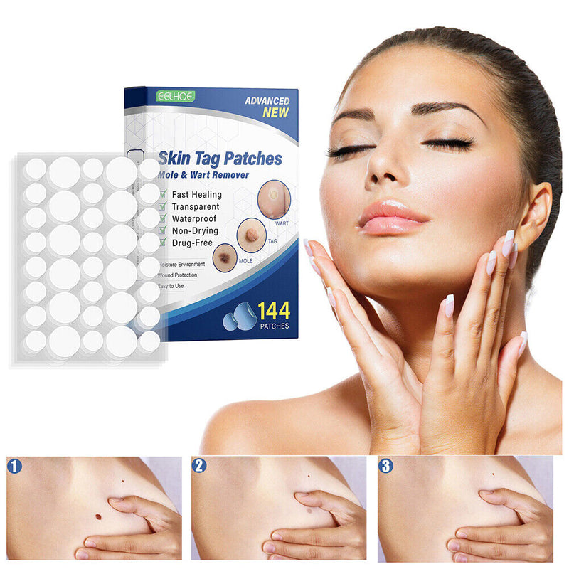 #A 144pcs Skin Tag Remover Patches Breathable Wart Treatment Stickers Cleaning
