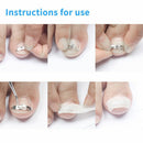 Nail Recover Pedicure Tools Paronychia Ingrown Toenail Straightener Correction