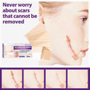 4pcs Silicone Scar Sheets Gel Strips Patch Adhesive Scar Removes (75mm)