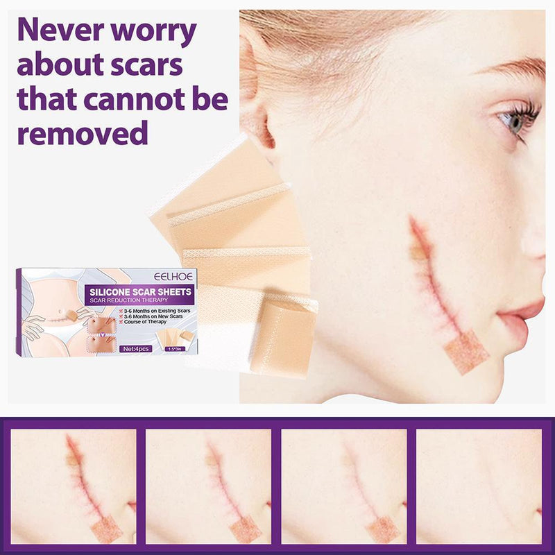 4pcs Silicone Scar Sheets Gel Strips Patch Adhesive Scar Removes (75mm)