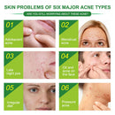 24pcs Ultra-thin Acne Pimple Remover Patches Acne Treatment Stickers Kit Newly