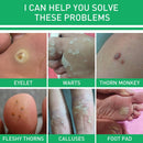 8259551-BURG-WÄCHTER, hardened chain combination with square rings + lucc