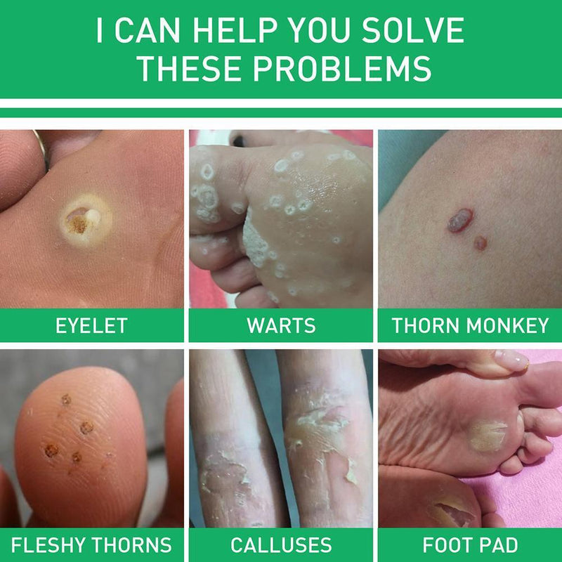 8259551-BURG-WÄCHTER, hardened chain combination with square rings + lucc