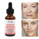 30ml Skin Whitening Lightening Brightening Serum Dark Spot S0F7 W1G5