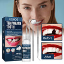 Tooth Filling Repair Beads for Missing Broken Teeth Strong Abrasion Resistance