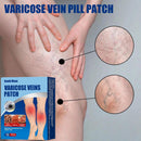 Varicose Vein Patch Leg Relief Blood Promote Patch Pain Smooth Vasculitis Q1B5