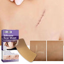 Self-Adhesive Scar Repair Stickers Silicone Scar Invisible Pad for Skin Beauty