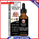 Nail Repair Fluid Health Care Foot Treatment Onychomycosis Paronychia Improve