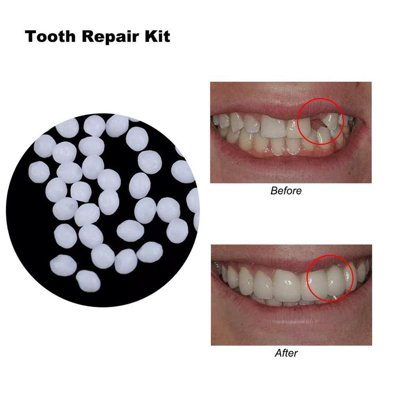 10g Denture Solid Glue Dental Restoration Temporary Tooth Repair Kit (10g)