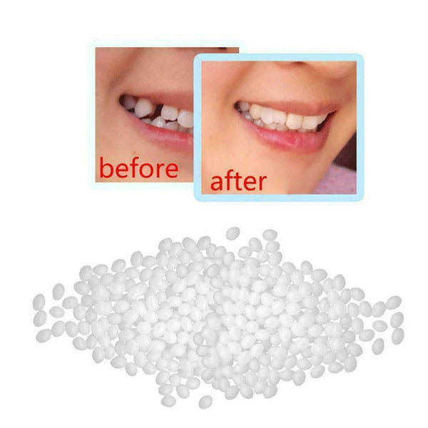 Temporary Tooth Replacement Material - 12 grams, 20ml, Repair teeth. Kit L0S4