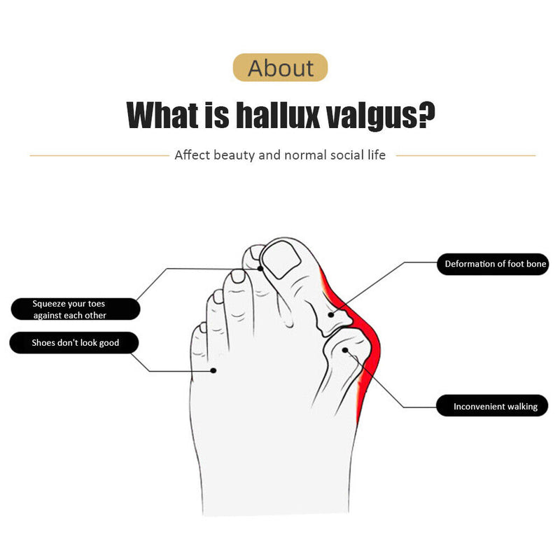 Foot Toe Separator Hallux Valgus Protector Thumb Corrector Bunion Foot Care
