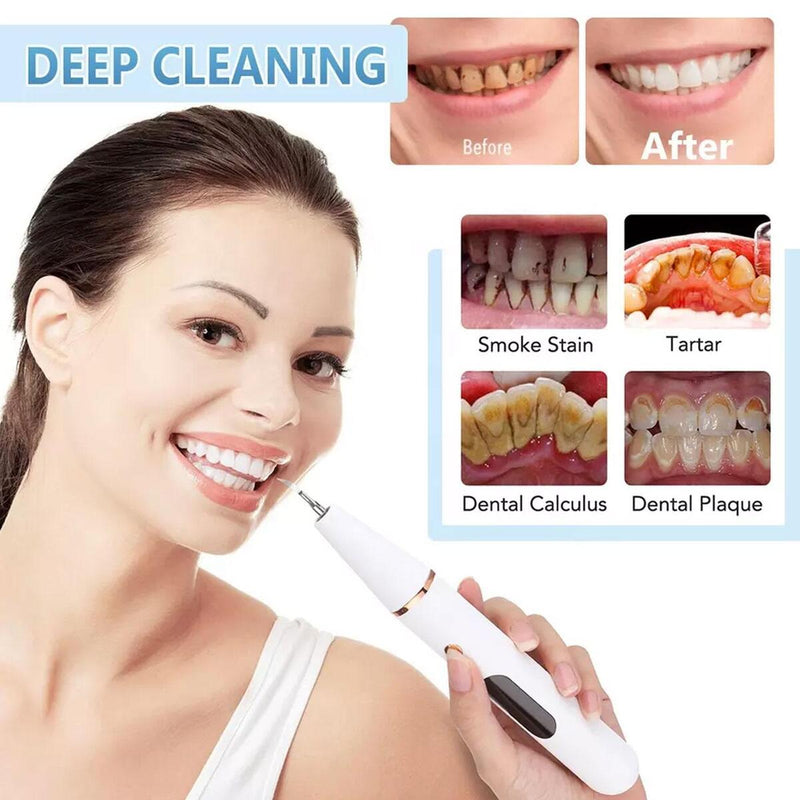 Electric Teeth Cleaning Professional Dental Calculus Plaque Remover Tools Kit~