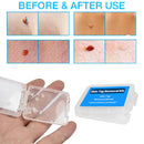 30pcs Skin Tag Remover Patch Kits Easy Clean Face Mole Band for Home Use Newly