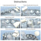 Dental Care Orthodontic Accessories Dental Material Orthodontic Mold